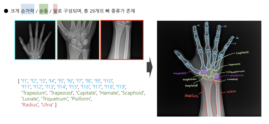 Hand bone semantic segmentation